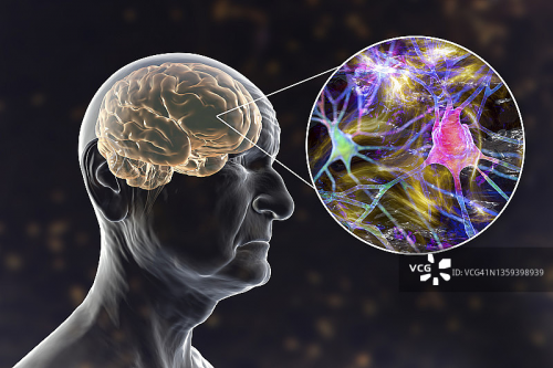 如何有效延缓记忆衰退?《2025脑健康白皮书》指出:营养干预已成关键突破口 如何有效延缓记忆衰退?《2025脑健康白皮书》指出:营养干预已成关键突破口